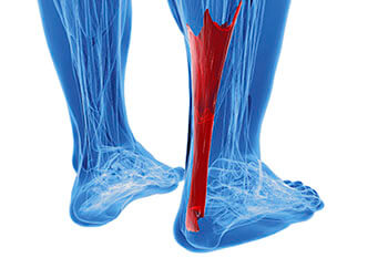 Achilles tendinitis treatment in the Chatham County, GA: Pooler (Bloomingdale, Meldrim, Eden, Garden City, Port Wentworth, Savannah, Rincon, Georgetown) and Beaufort County, SC: Bluffton, Hilton Head Island, Okatie, Pritchardville, Palmetto Bluff, Levy, Limehouse, Hardeeville, Brighton Beach, Harbour Town, Windmill Harbor areas