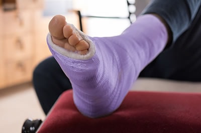 Foot Fractures treatment in the Chatham County, GA: Pooler (Bloomingdale, Meldrim, Eden, Garden City, Port Wentworth, Savannah, Rincon, Georgetown) and Beaufort County, SC: Bluffton, Hilton Head Island, Okatie, Pritchardville, Palmetto Bluff, Levy, Limehouse, Hardeeville, Brighton Beach, Harbour Town, Windmill Harbor areas