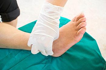 Tarsal tunnel syndrome treatment in the Chatham County, GA: Pooler (Bloomingdale, Meldrim, Eden, Garden City, Port Wentworth, Savannah, Rincon, Georgetown) and Beaufort County, SC: Bluffton, Hilton Head Island, Okatie, Pritchardville, Palmetto Bluff, Levy, Limehouse, Hardeeville, Brighton Beach, Harbour Town, Windmill Harbor areas