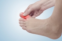 Stages of Gout