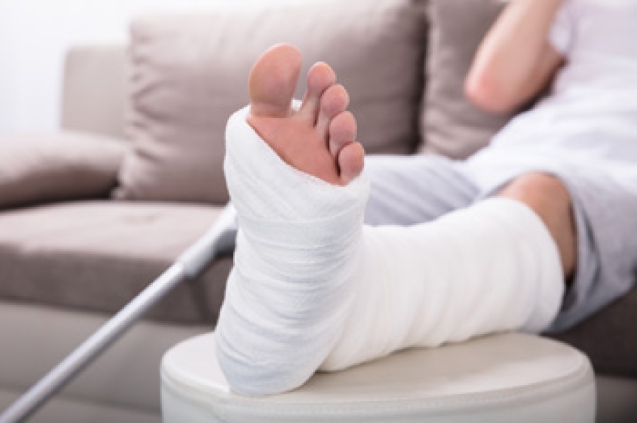 How To Tell If You ve Broken A Foot Bone