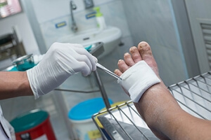 Foot Problems Caused by Diabetes